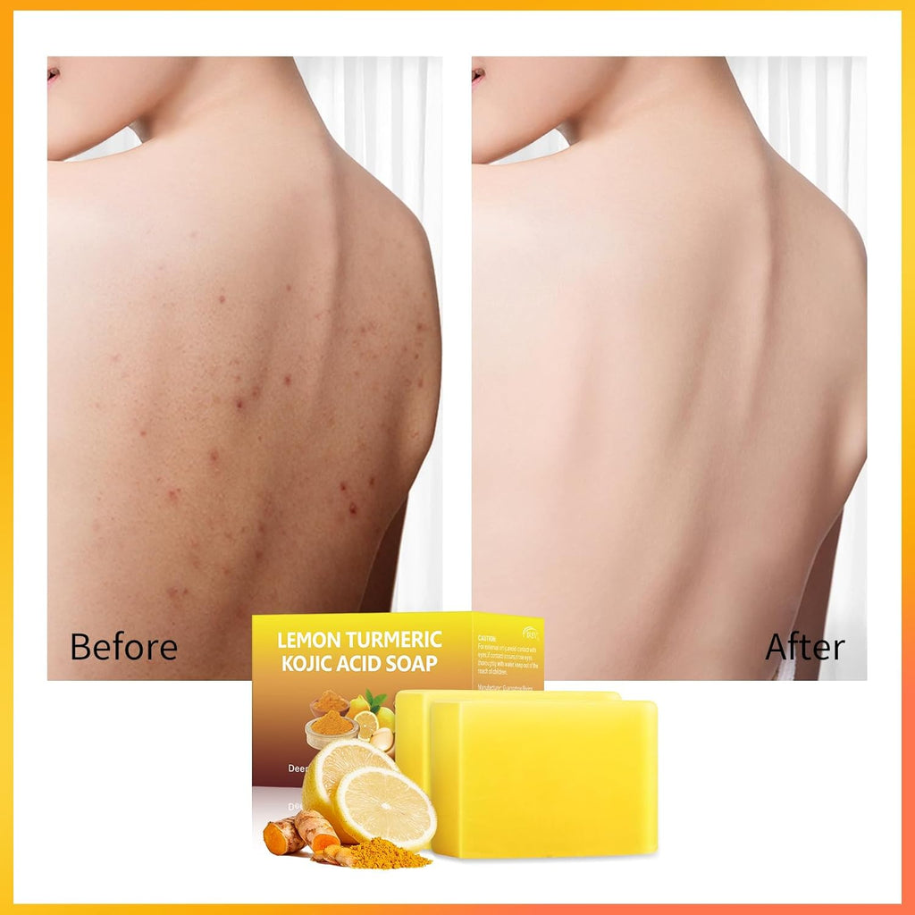 Lemon Turmeric Kojic Acid Soap Bar (2 Pack) F242778