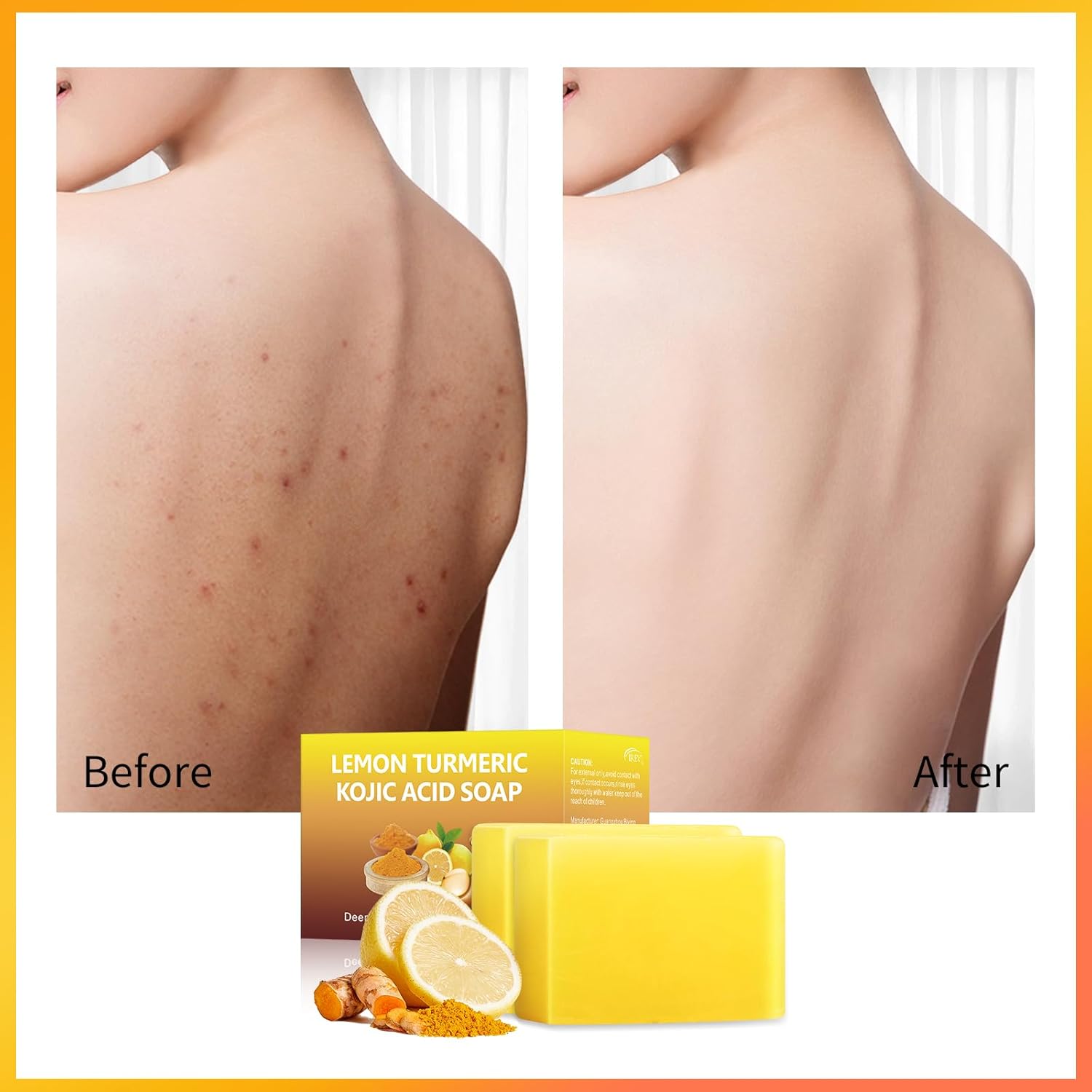 Lemon Turmeric Kojic Acid Soap Bar (2 Pack) F242778