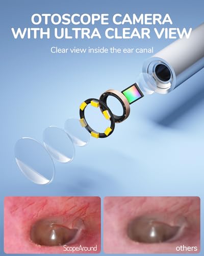 Otoscope Ear Camera with 4.5" IPS Screen, 1920x1080 FHD Smart Visual Ear Cleaner with Camera Tool Kit Q73547