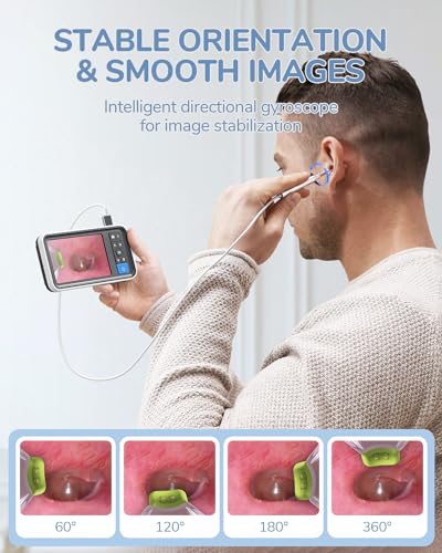 Otoscope Ear Camera with 4.5" IPS Screen, 1920x1080 FHD Smart Visual Ear Cleaner with Camera Tool Kit Q73547