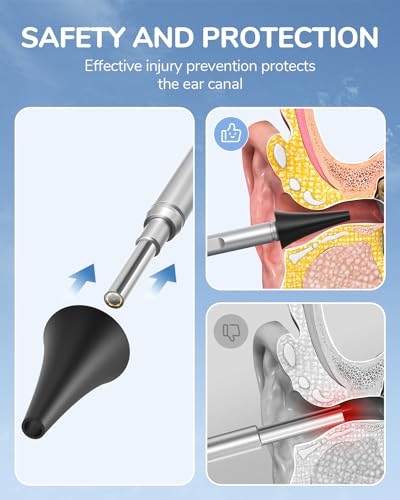 Otoscope Ear Camera with 4.5" IPS Screen, 1920x1080 FHD Smart Visual Ear Cleaner with Camera Tool Kit Q73547